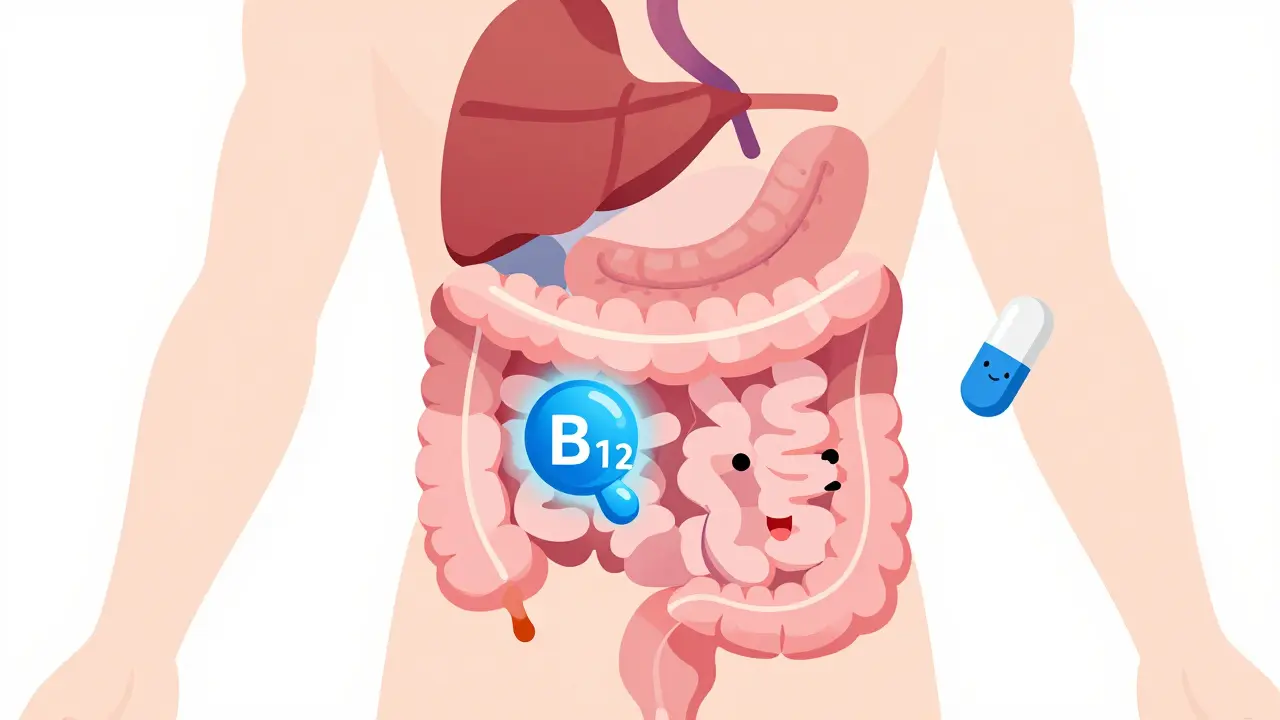 Illustration showing metformin affecting vitamin B12 absorption in the gut
